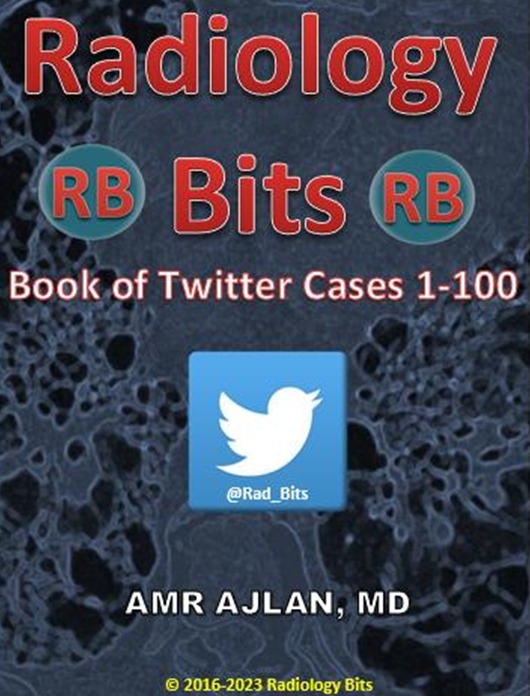 Radiology Bits Book of Twitter Cases 1-100