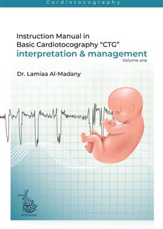 Instruction Manual in Basic Cardiotocography “CTG” interpretation and management (1)